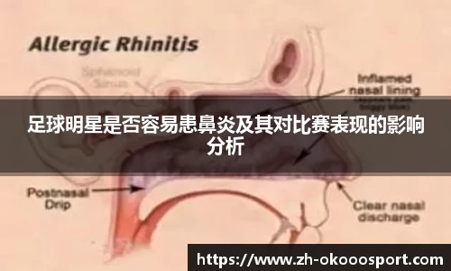 足球明星是否容易患鼻炎及其对比赛表现的影响分析